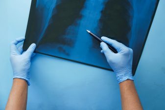 How Serious Is Fluid in the Lungs in Elderly? Warning Signs You Can’t Ignore