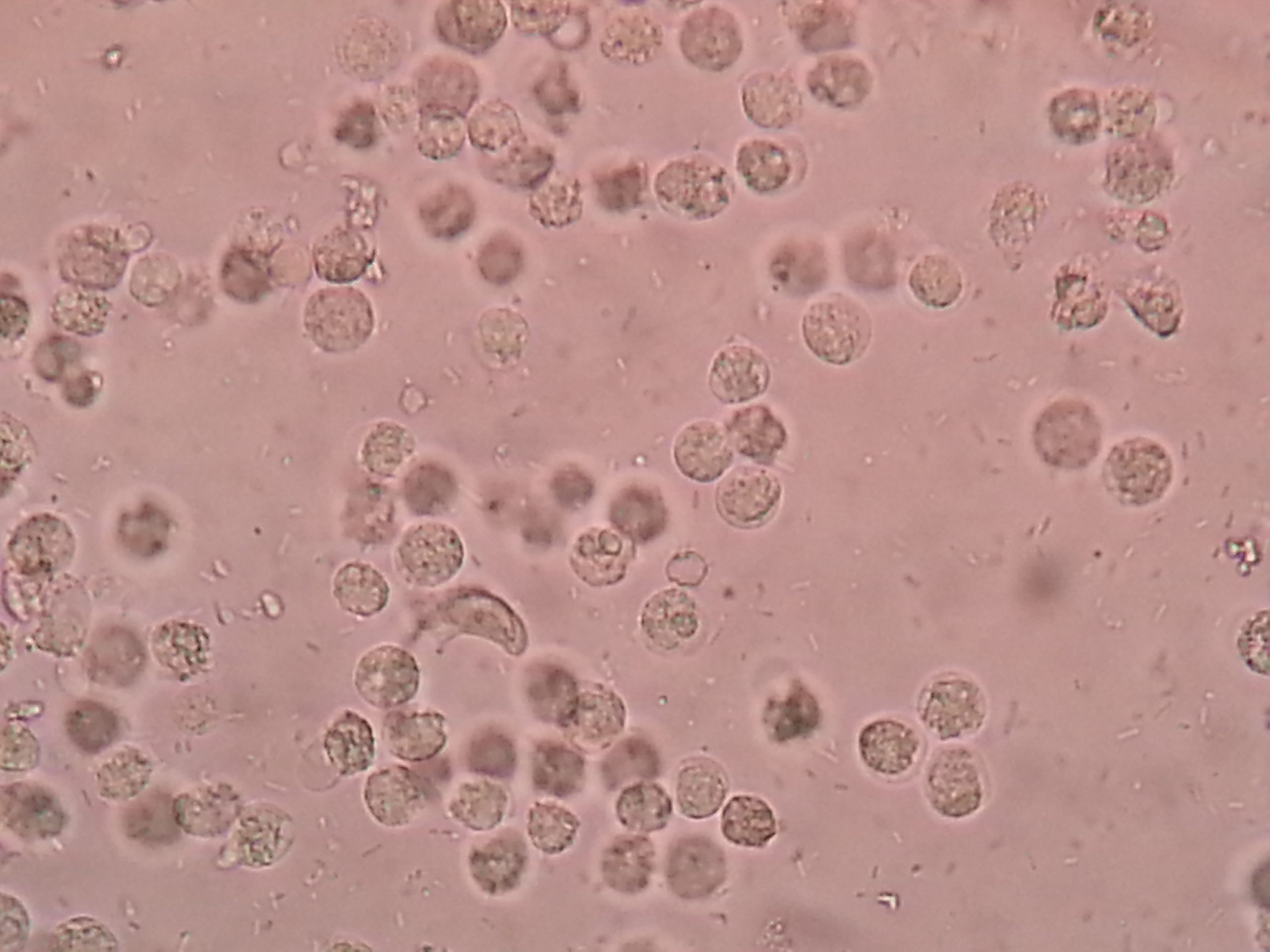 Why UTIs in Elderly Often Go Unnoticed: Warning Signs You Can’t Miss